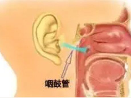 全國(guó)愛耳日 專家談急性化膿性中耳炎