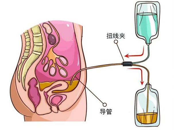 優(yōu)勢(shì)學(xué)科｜腎臟替代治療——醫(yī) 護(hù) 患一體化腹膜透析管理模式